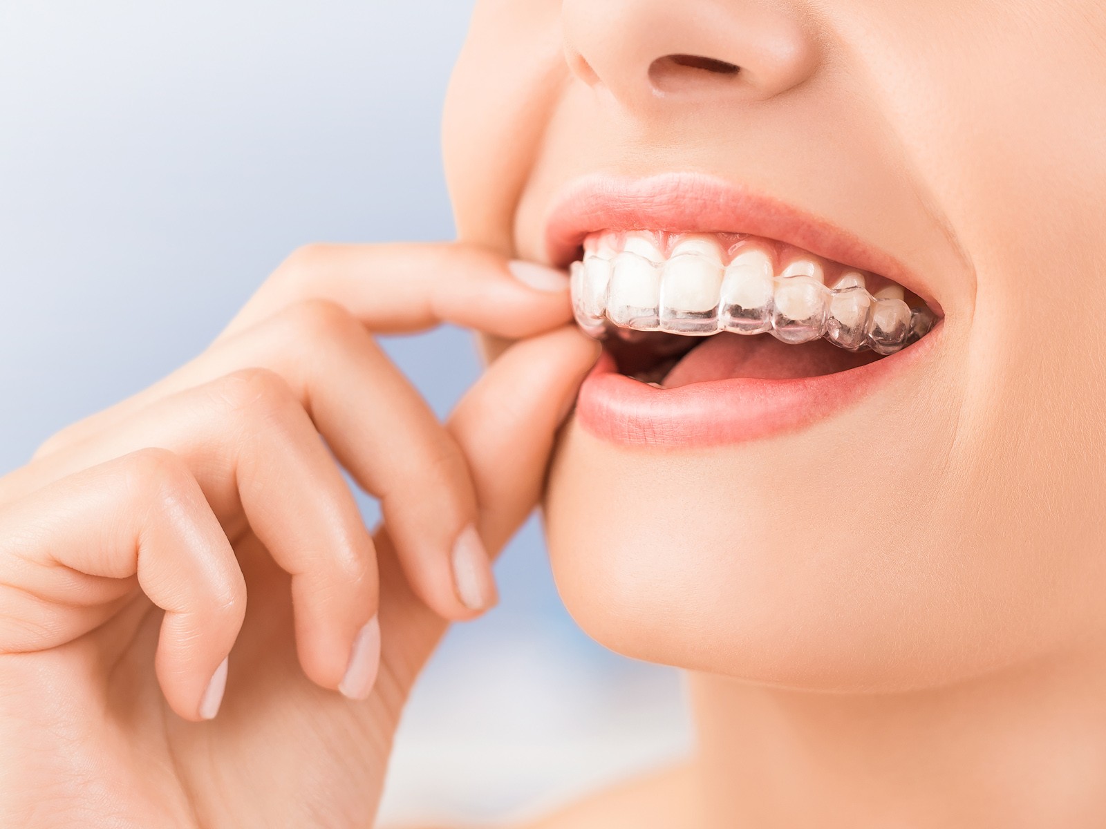 How long does it take to start seeing Invisalign results?