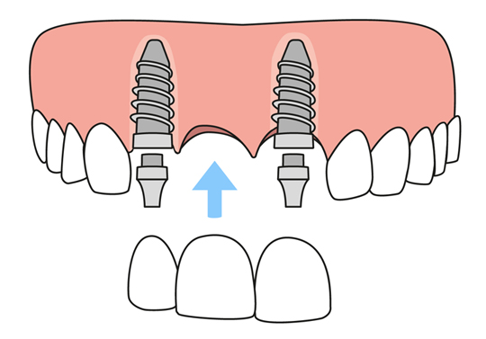 78387 TX Dentist