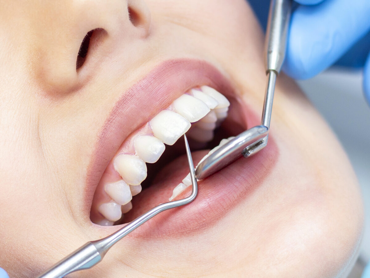 Do regular dental cleaning improve dental health?