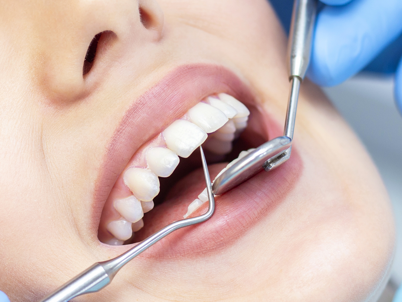 Do regular dental cleaning improve dental health?