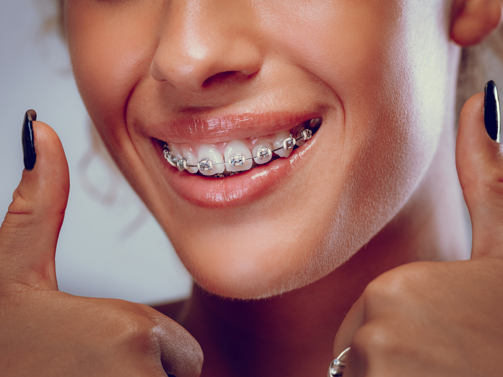 5 Ways Orthodontics Can Improve Your Overall Oral Health