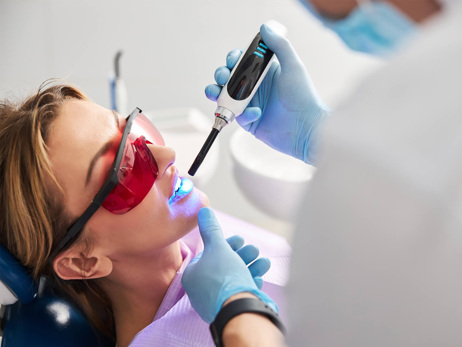 What is a Glass Ionomer Sealant?