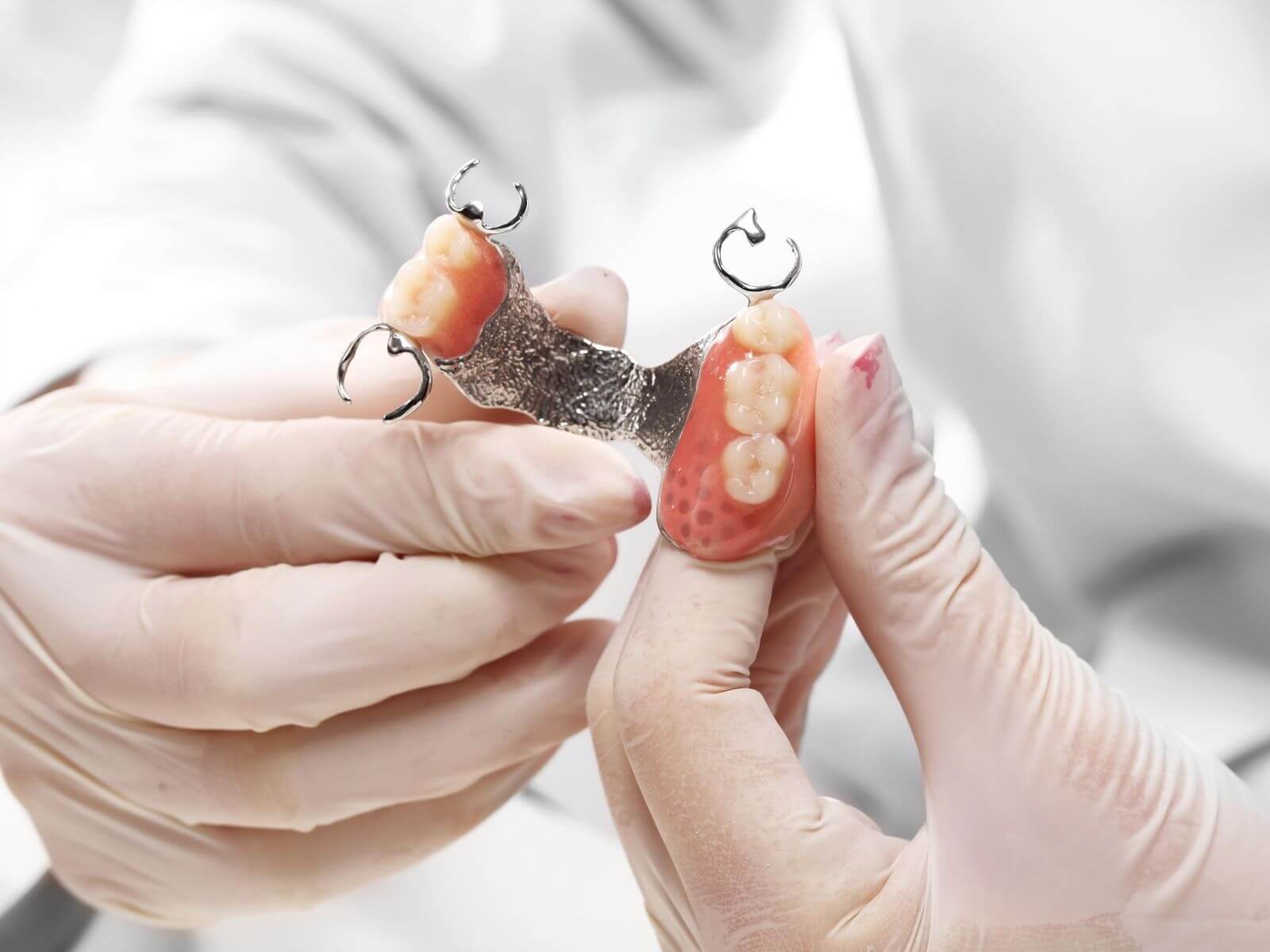 Understanding Dental Implant Overdentures?