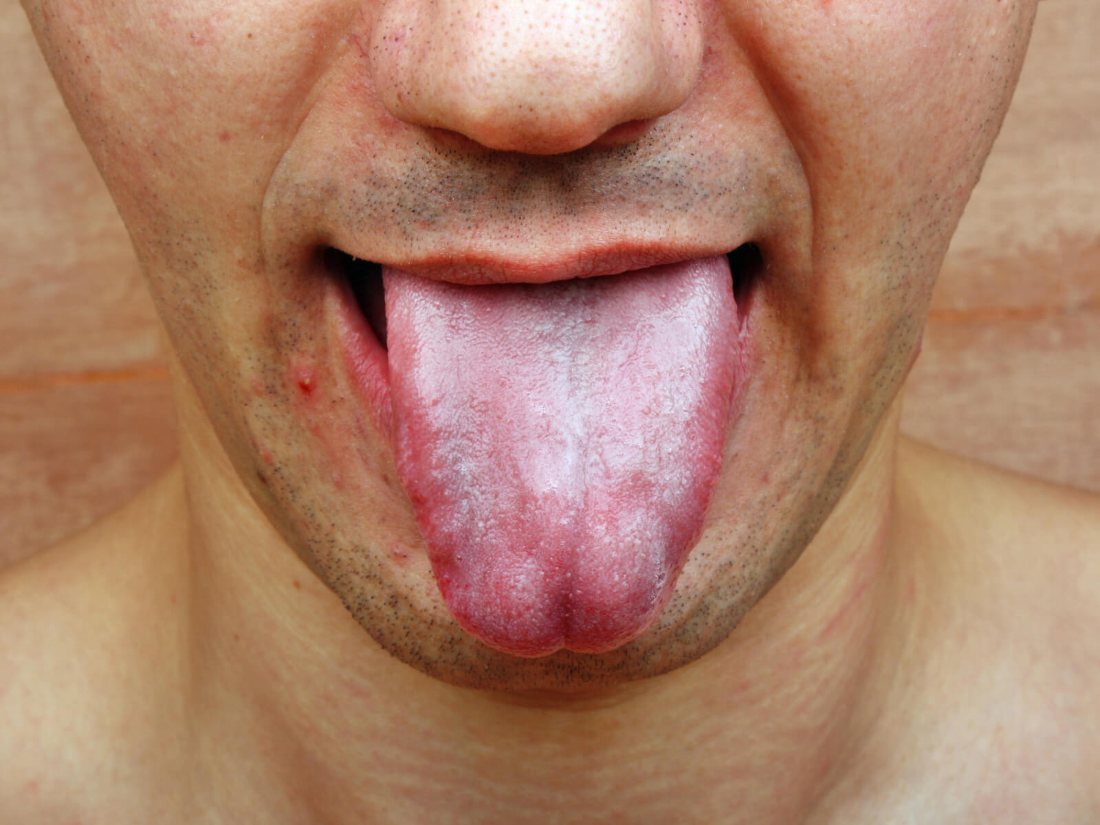 7 Health Benefits of a Tongue Scraper
