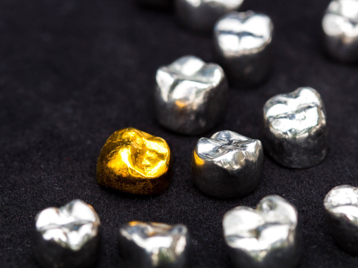 Are Dental Crowns Covered By Insurance? Here’s What To Know