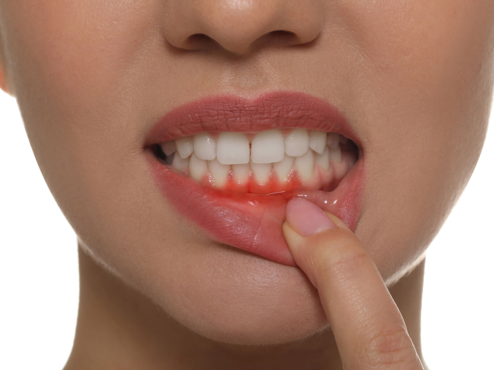 How To Recognize Gum Disease Symptoms In Diabetic Children