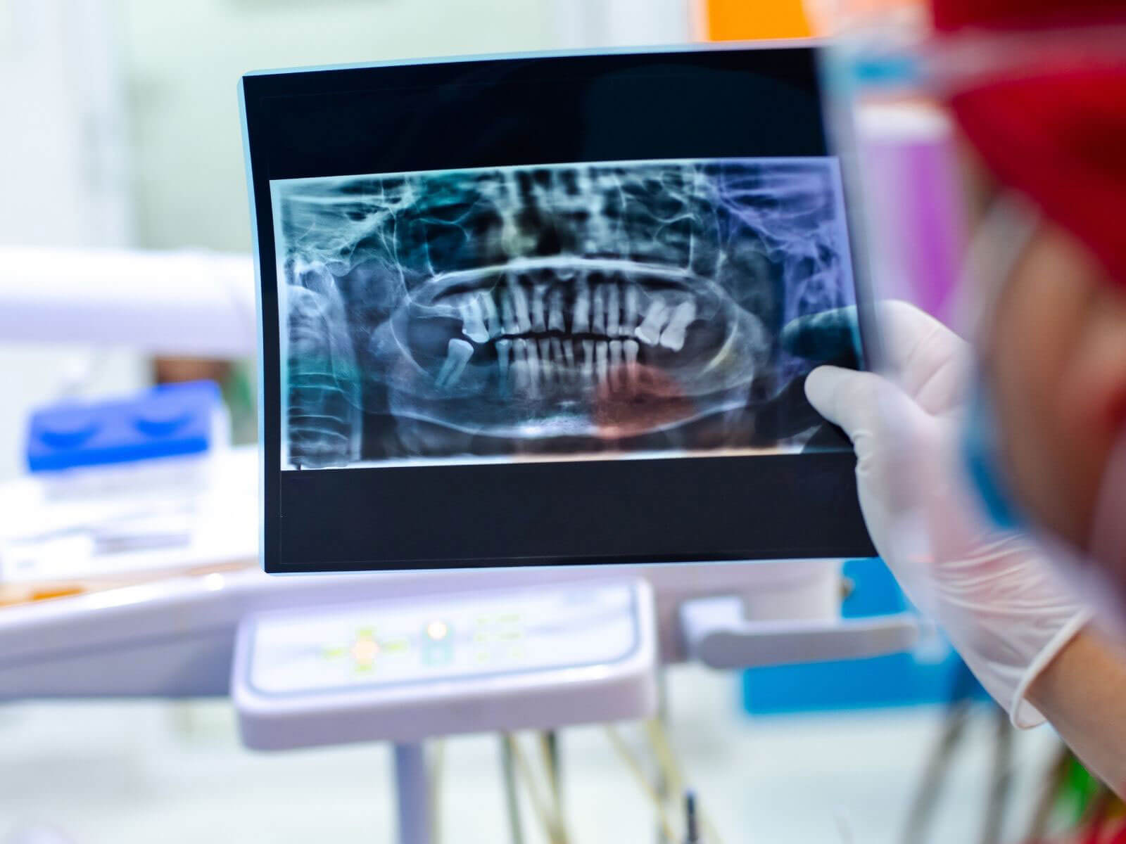 The Role of 3D Imaging In Planning Dental Implant Surgery