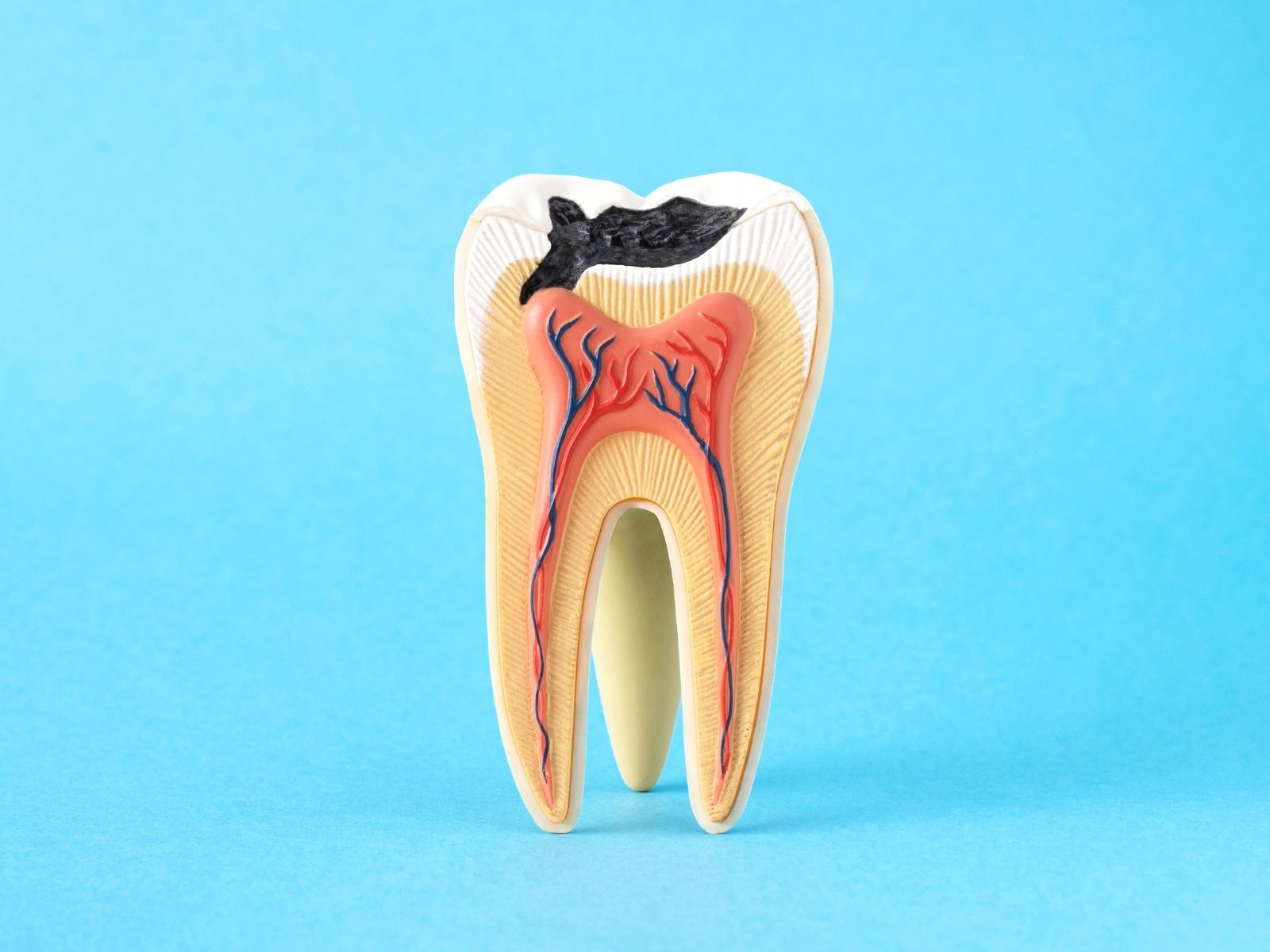 Root Canal Infection: How to Recognize It and What to Do Next