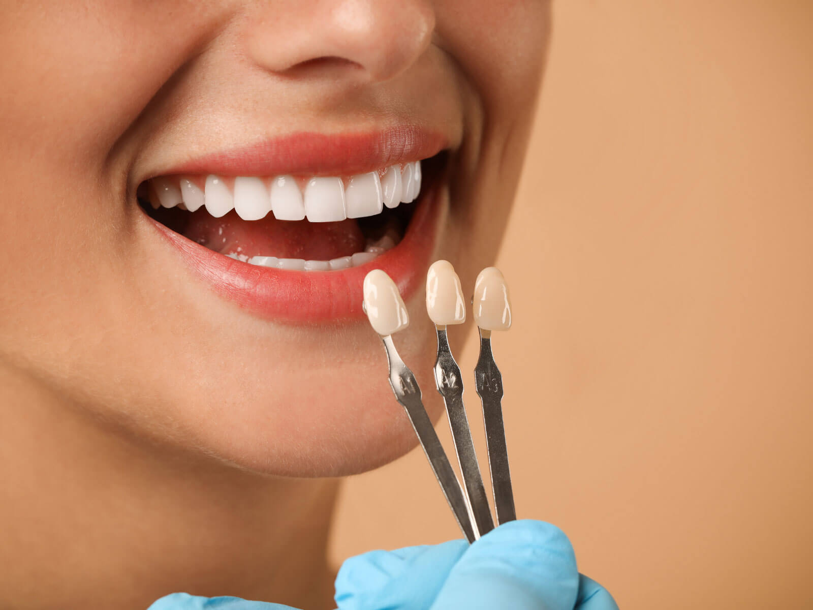 7 Best Snap-On Veneers for Missing Teeth: Top Options Compared