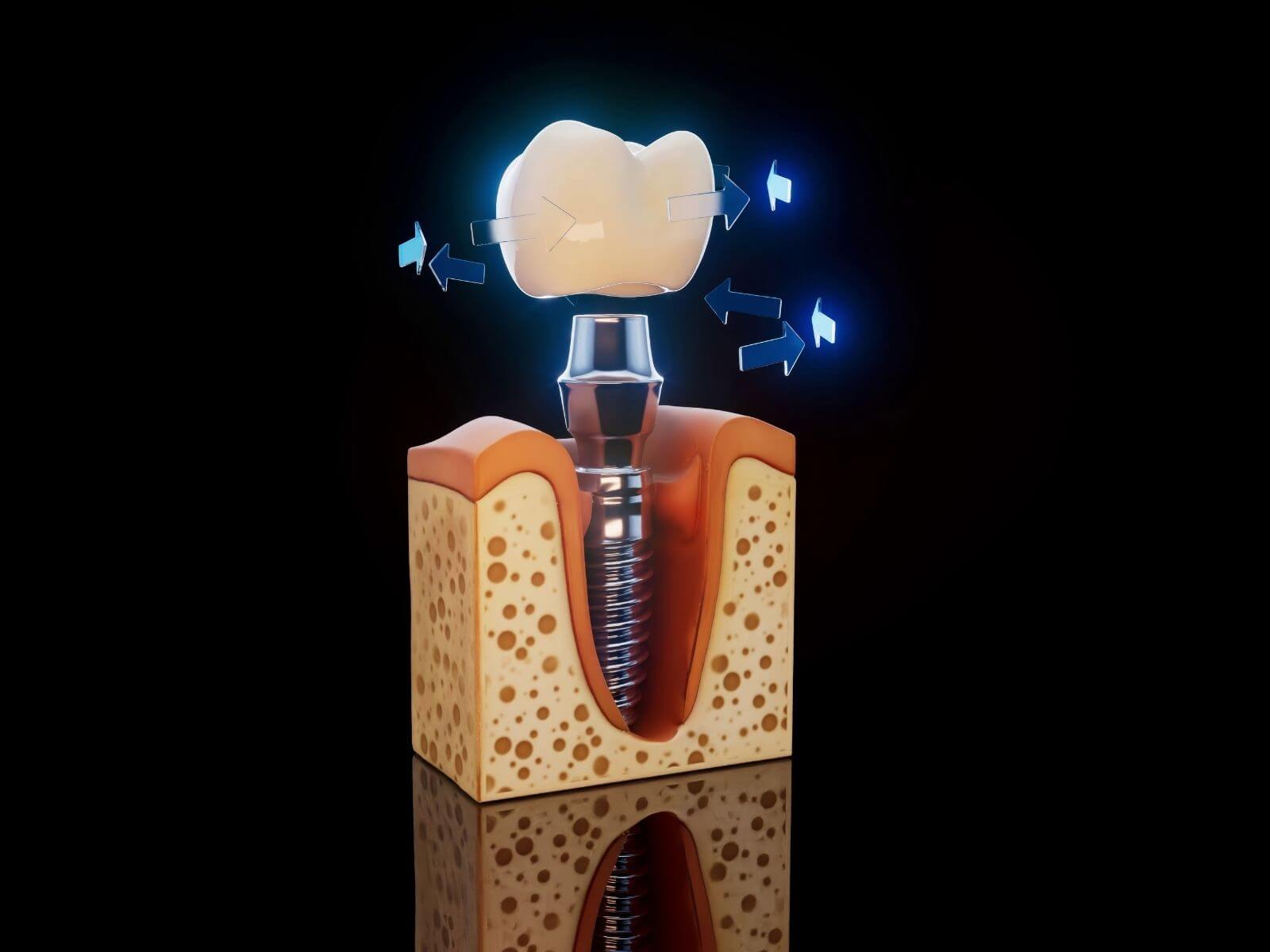 Dental Crown Cost in 2026: Prices by Material, Insurance, and Financing